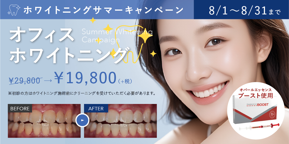 ホワイトニングサマーキャンペーン